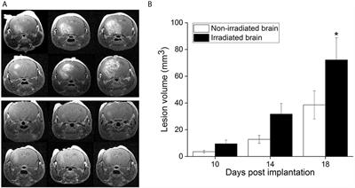 Irradiation-Modulated Murine Brain Microenvironment Enhances GL261-Tumor Growth and Inhibits Anti-PD-L1 Immunotherapy